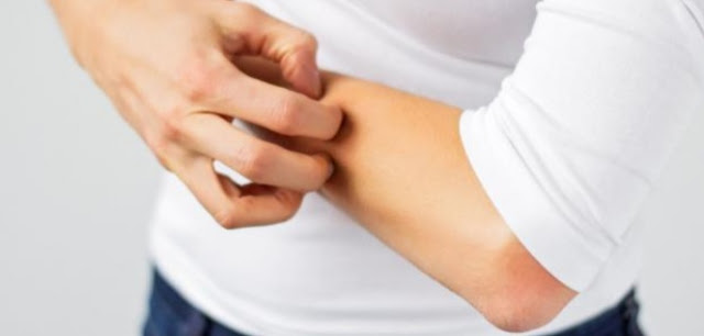 الشعور بالحكة الشعور بالحكة