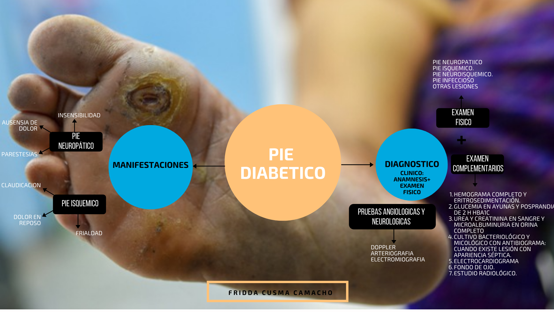 Para recordar al toque MAPA MENTAL PIE DIABETICO (CLINICA Y DX)