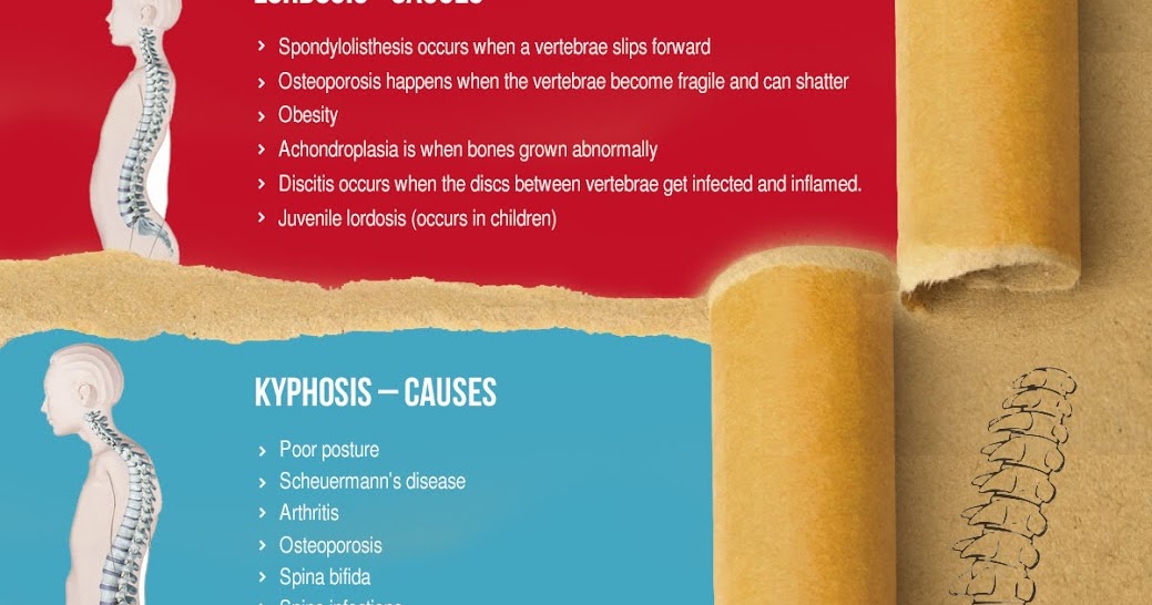 Types of spinal problems and treatments Kauvery Hospitals