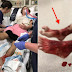 WATCH: This Boy Filled His Legs With Blood After Dipping It In The Ocean, Find Here Why!