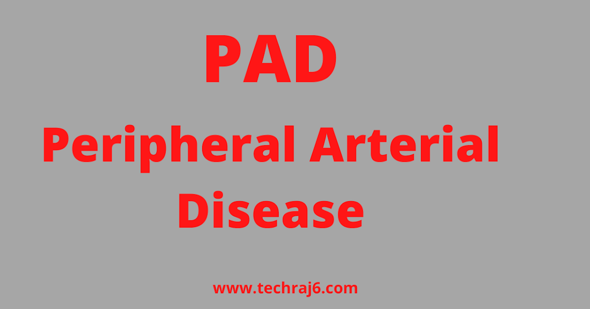 PAD full form, What is the full form of PAD