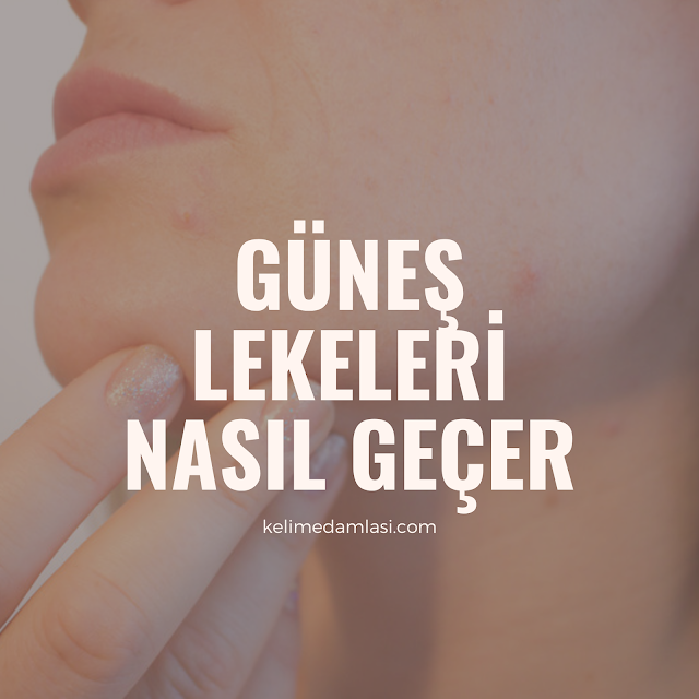 güneş lekesi tedavisi