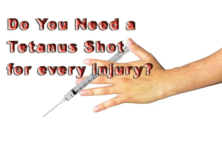 Do You Need a Tetanus Shot for every injury?, Tetanus Shot for