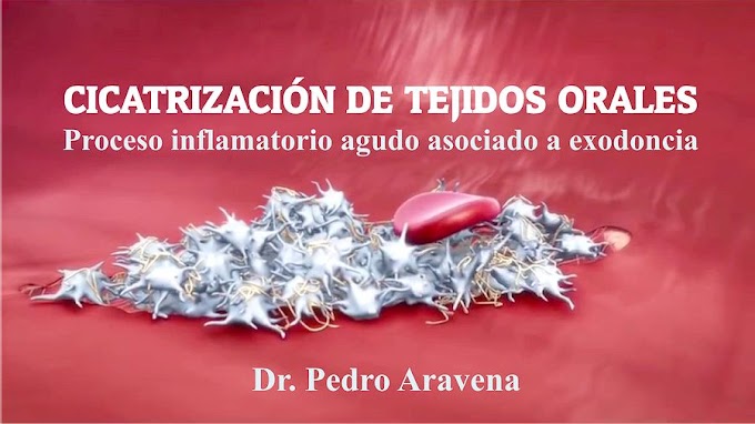 EXODONCIA: Cicatrizacion de tejidos orales. Proceso inflamatorio agudo - Prof. Pedro Aravena