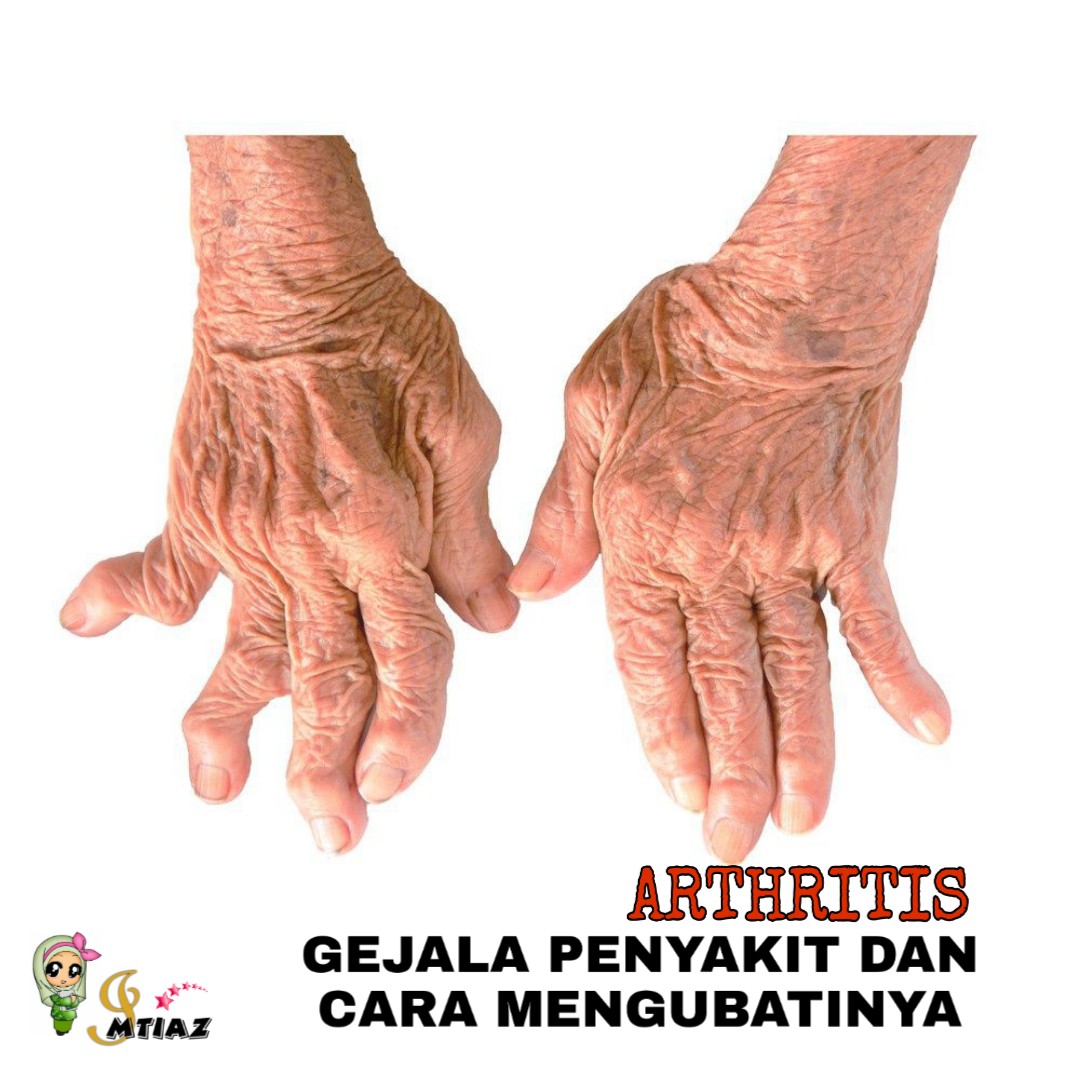APAKAH PENYAKIT ARTHRITIS, PUNCA GEJALA TERJADINYA PENYAKIT INI DAN