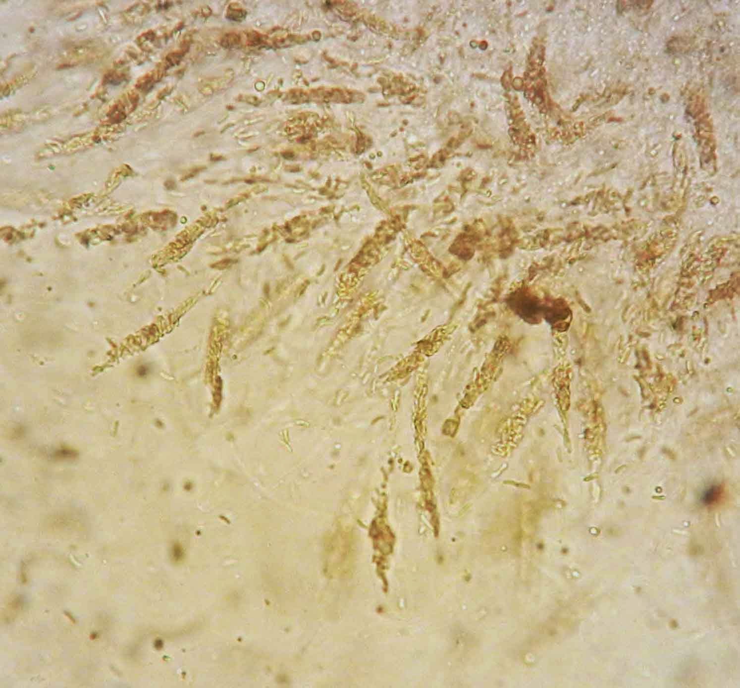 Diatrypella asci produce numerous ascospores