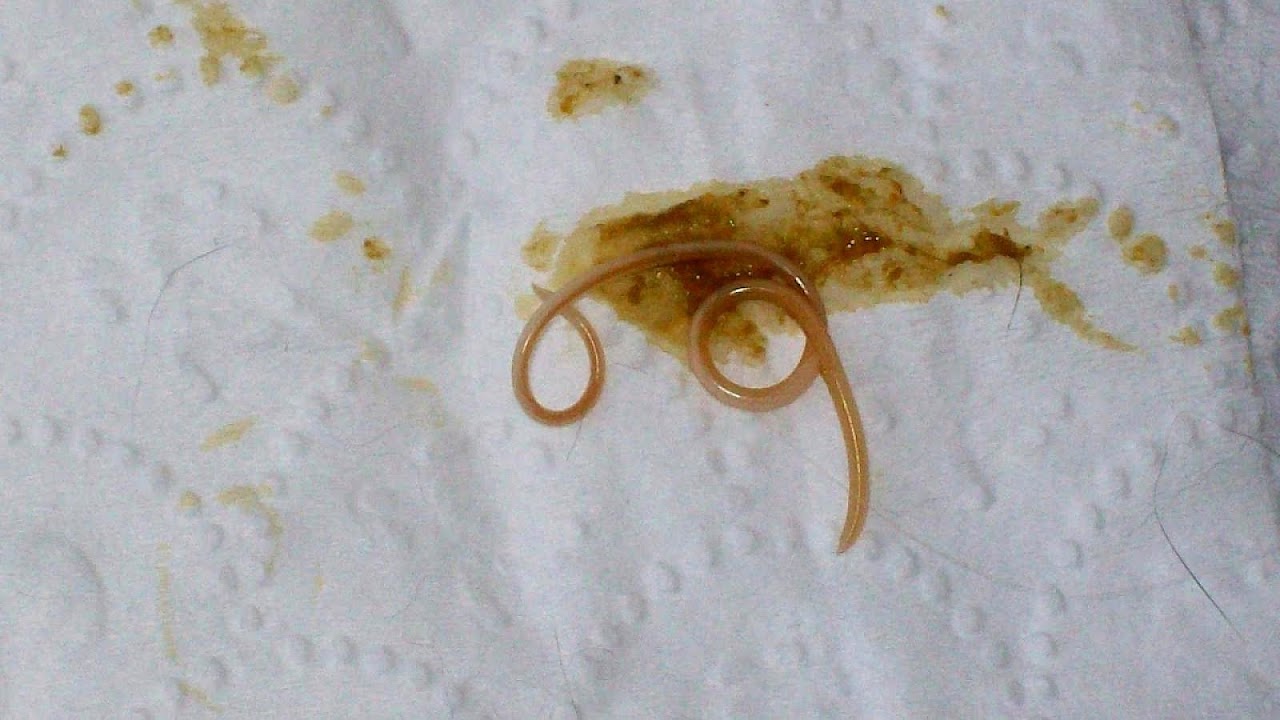 Why Is My Cat Vomiting White Foam Cat Choices