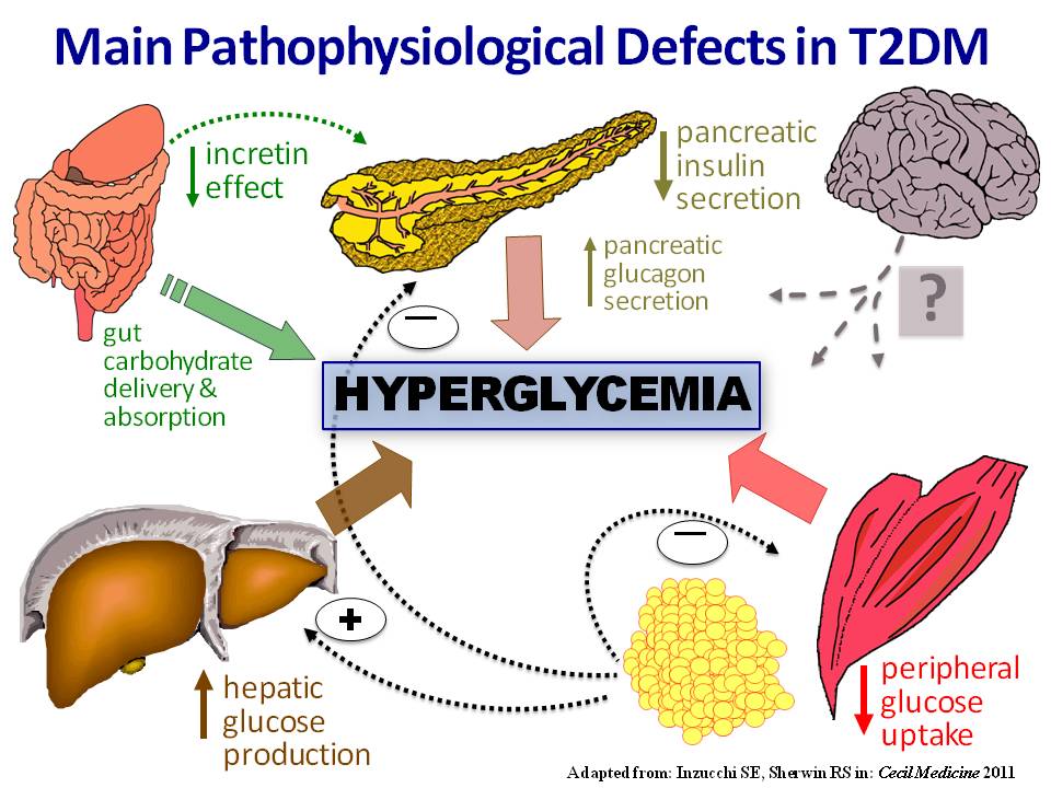 Causes and Effects of Diabetes Diabetes Symptoms Reviews