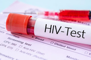 Hiv test Blood group that can resist hiv