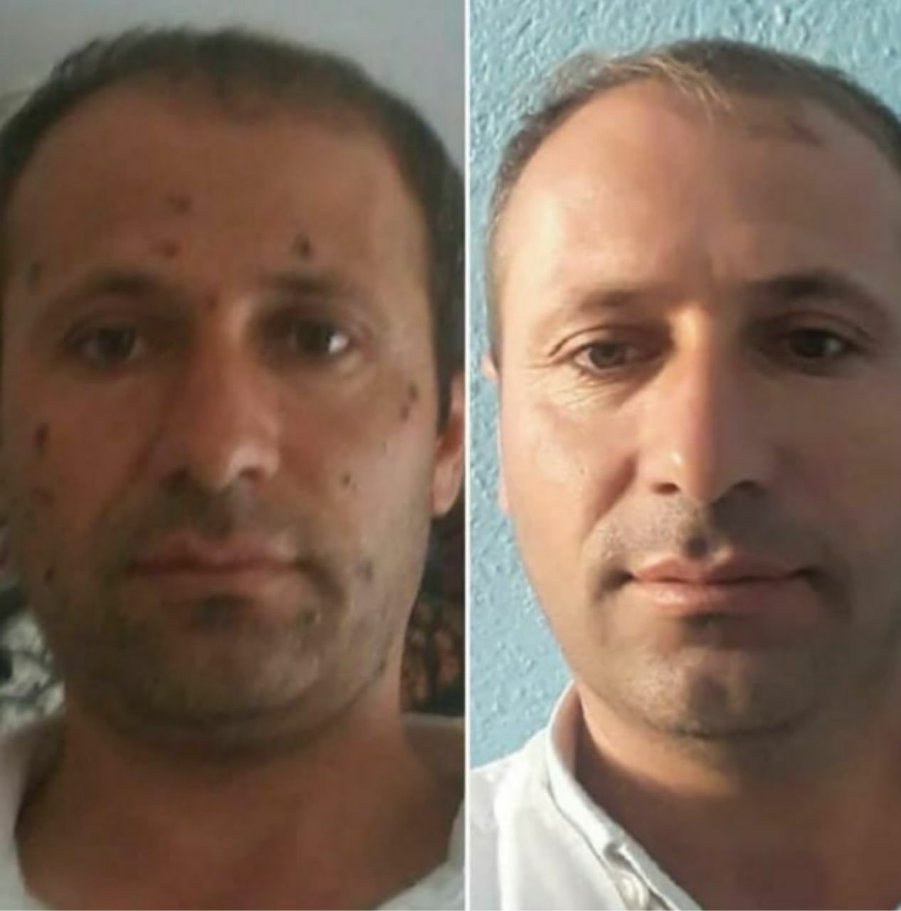 Ürünümüzü kullananlar? Öncesi ve Sonrası Fotoğrafları Bitkisel Ben