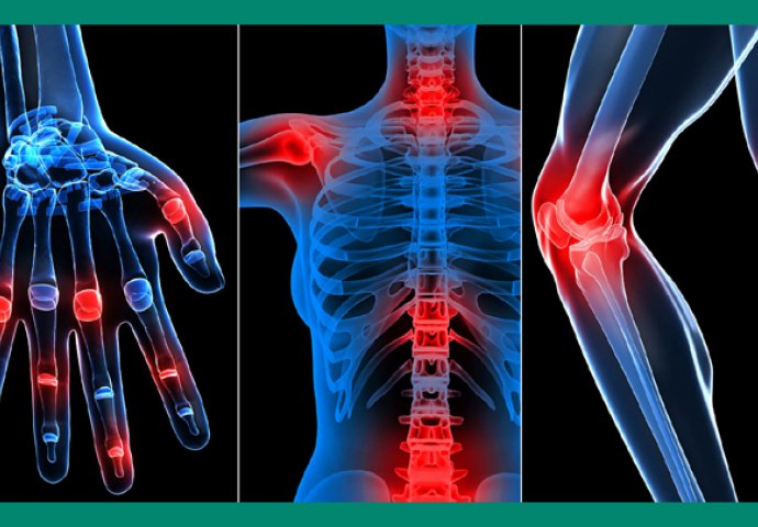 njemački lijek protiv bolova u zglobovima bol s artrozom ramenog zgloba