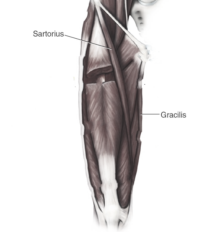 Active Knee stabilizers