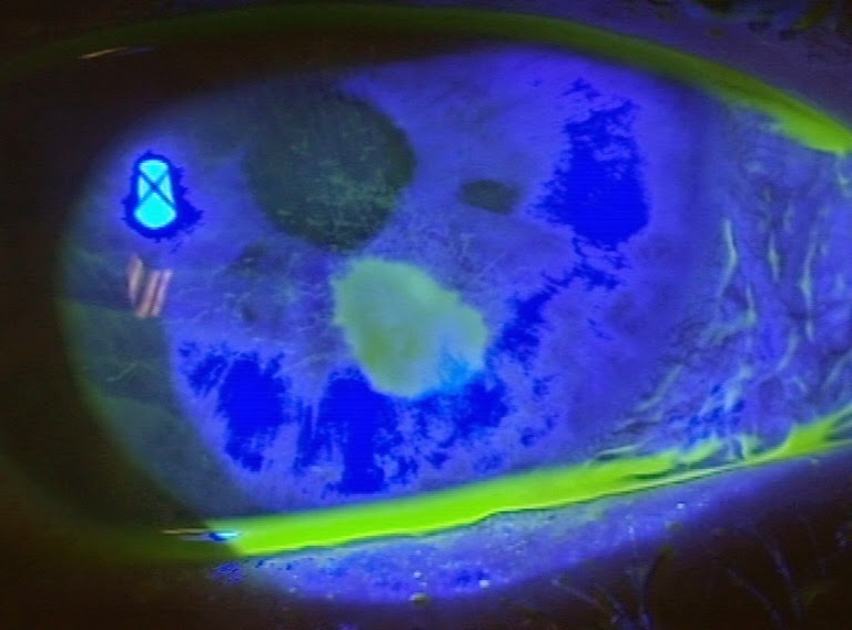 All things eye Por Yong Ming Stories of stubborn grit in the eye