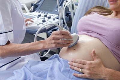 Placenta previa: What is it and what to do when it occurs?