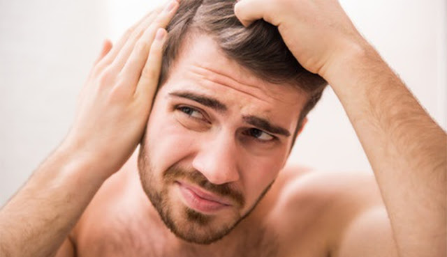 Male Hair Loss Treatment