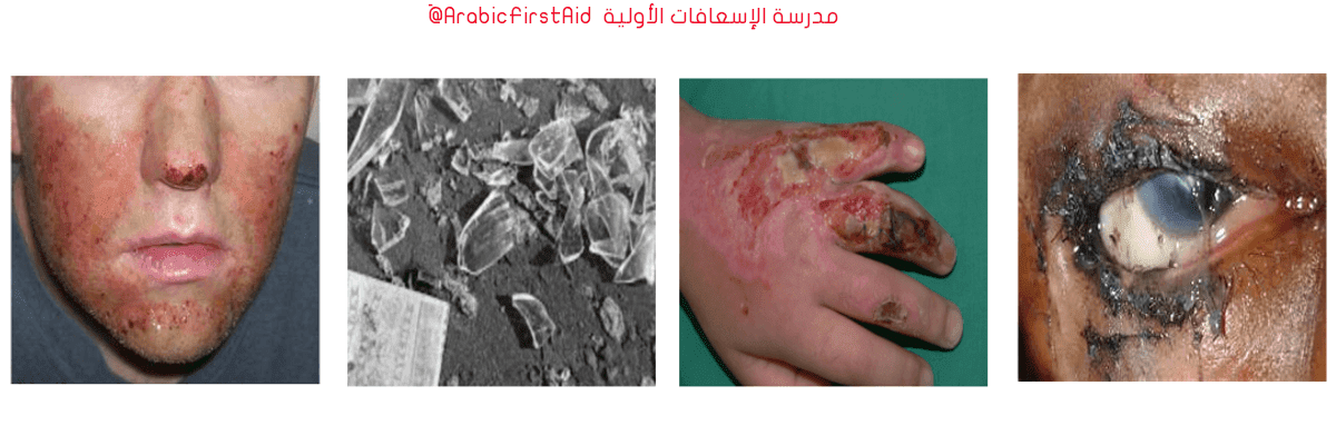 First-Aid-laboratory-injuries
