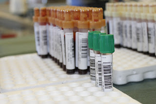 Image: Test tubes of blood draws, by Antonio Corigliano on Pixabay