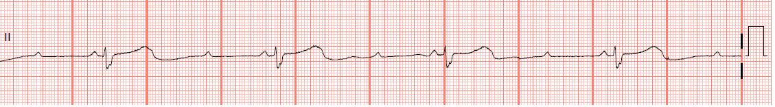 Float Nurse Pediatric Advance Life Support Unstable