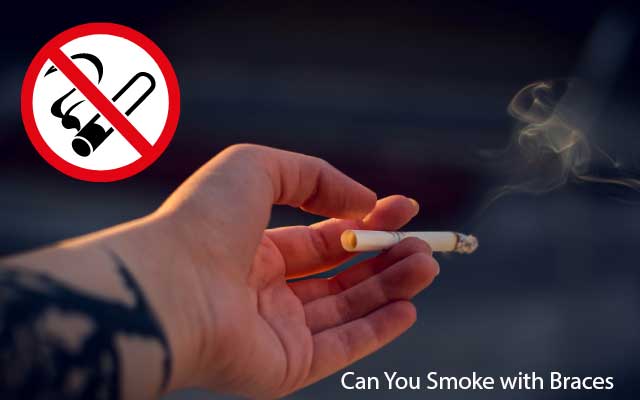 Can You Smoke with Braces