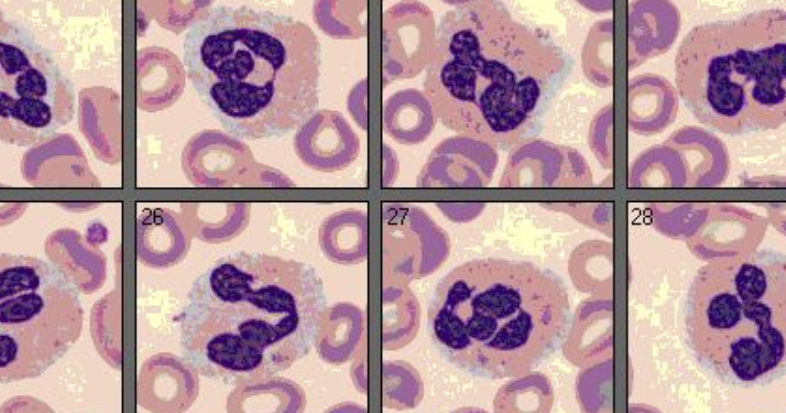 كريات الدم البيضاء White Blood Cells