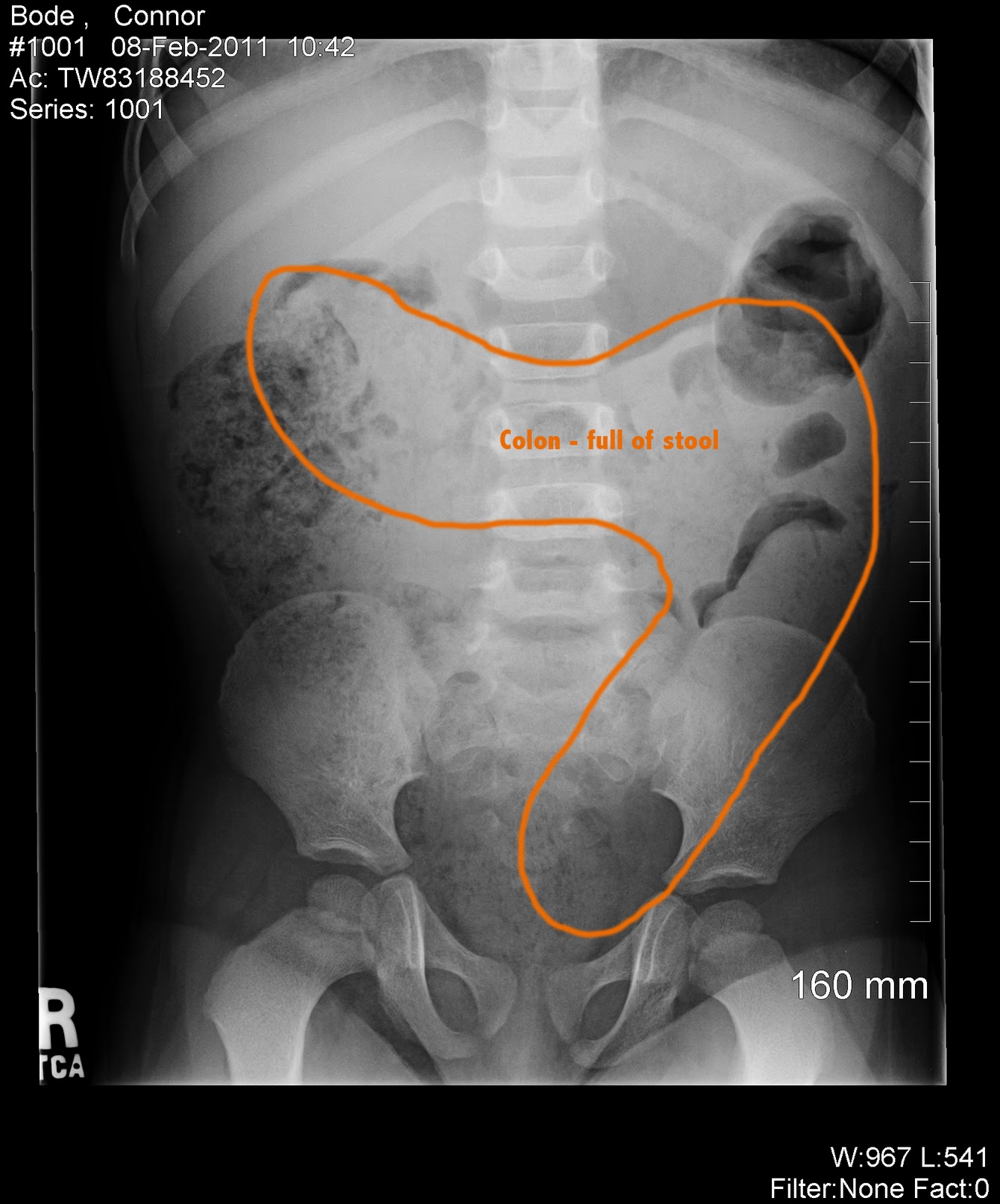 a peek into 31 otter court February 2011