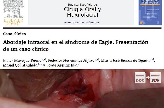 PDF: Abordaje intraoral en el síndrome de Eagle - Presentación de un caso clínico