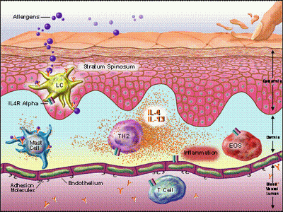 Functional Wisdom...healthy updates from Dr. Jill!: Is Leaky Gut