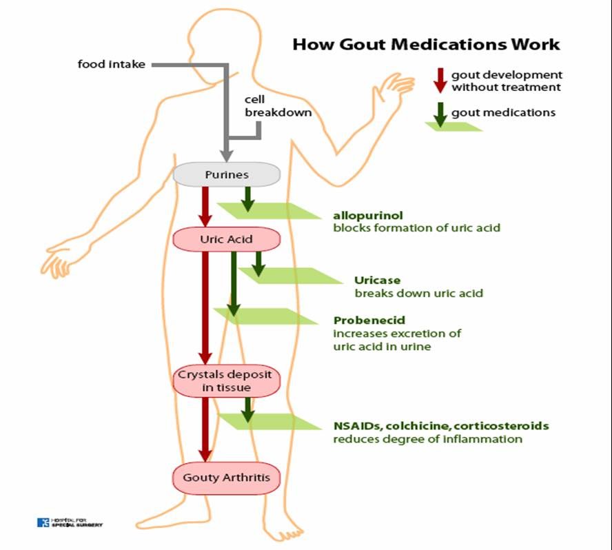 HEALTH FROM TRUSTED SOURCES: Gout