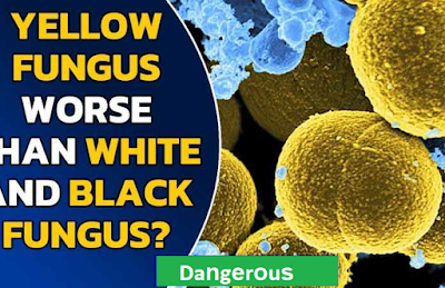 Yellow Fungs Kya Hai ? Yellow Fungs Symptoms || What Is Yellow Fungs ? 1 yellow fungs kya hai