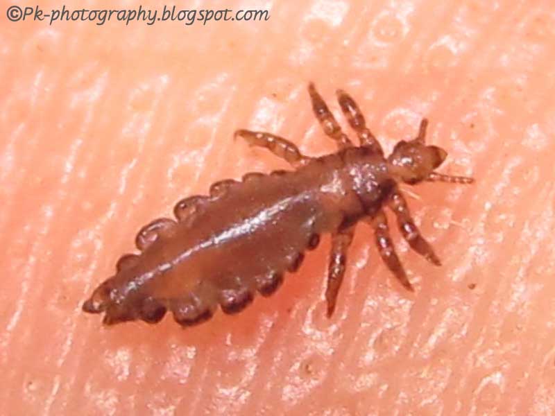 Head Lice Pictures 95