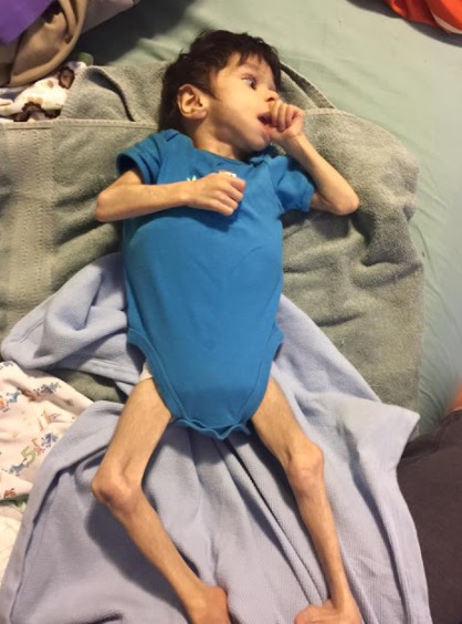 Budak Lelaki Ini Hanya Tinggal Rangka Ketika Diambil Oleh Keluarga Angkatnya. Tetapi Selepas Beberapa Bulan, Lihat Perubahan Luar Biasanya Budak Lelaki Ini Hanya Tinggal Rangka Ketika Diambil Oleh Keluarga Angkatnya. Tetapi Selepas Beberapa Bulan, Lihat Perubahan Luar Biasanya