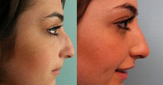 Chuck's Fun Page 2: Celebrity make-overs