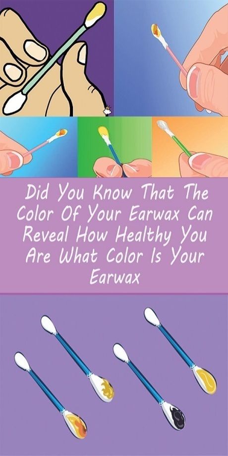 DID YOU KNOW THAT THE COLOR OF YOUR EARWAX CAN REVEAL HOW HEALTHY YOU