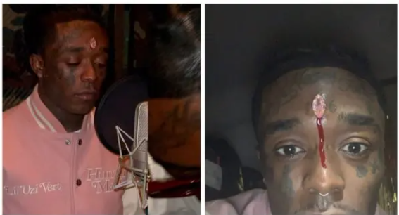 Lil Uzi Vert cries out after bleeding due to the diamond piercing he did on his forehead