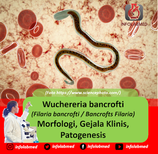 Wuchereria bancrofti (Filaria bancrofti Bancrofts Filaria) Morfologi, Gejala Klinis, Patogenesis