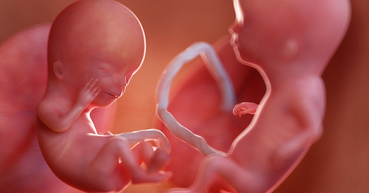 Gêmeos Um Feto Menor Que O Outro 25/8/2020 | Médicos chineses propõem matar gêmeos e trigêmeos não