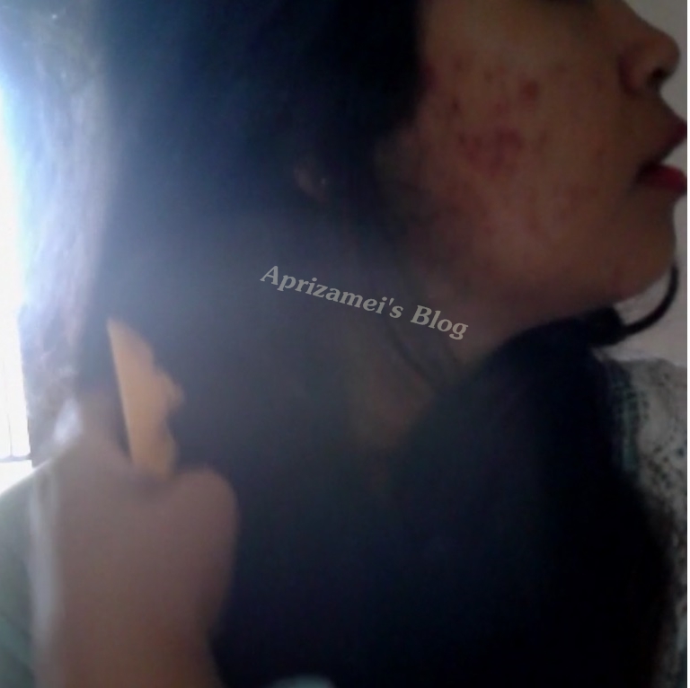 Meilly S Notes Jerawat Muncul Setelah Totok Wajah Jangan Panik Dulu