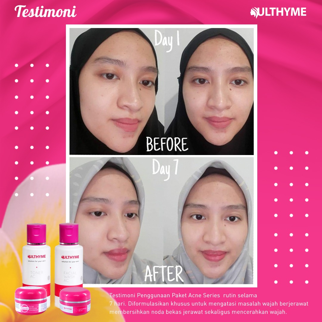 ulthyme skincare