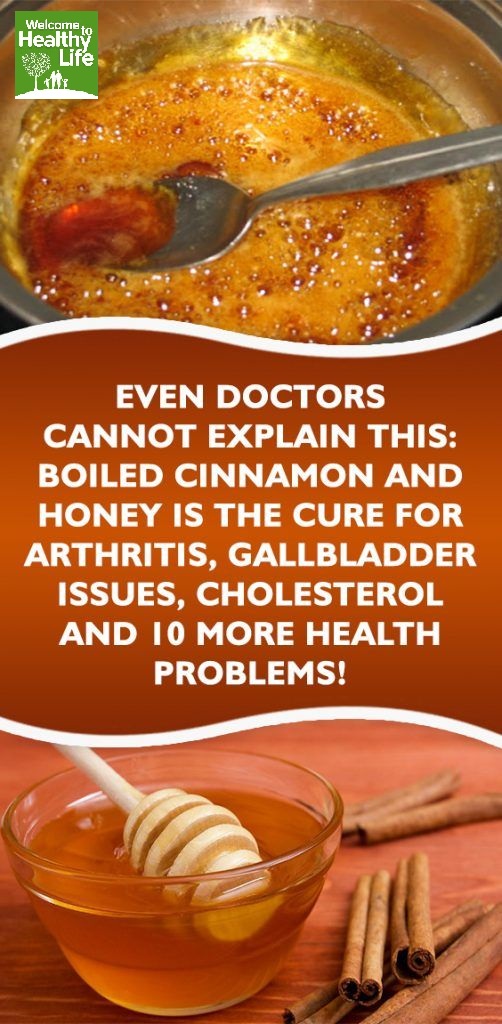 Boil Honey And Cinnamon and Treat Cholesterol, Gallbladder, Cancer