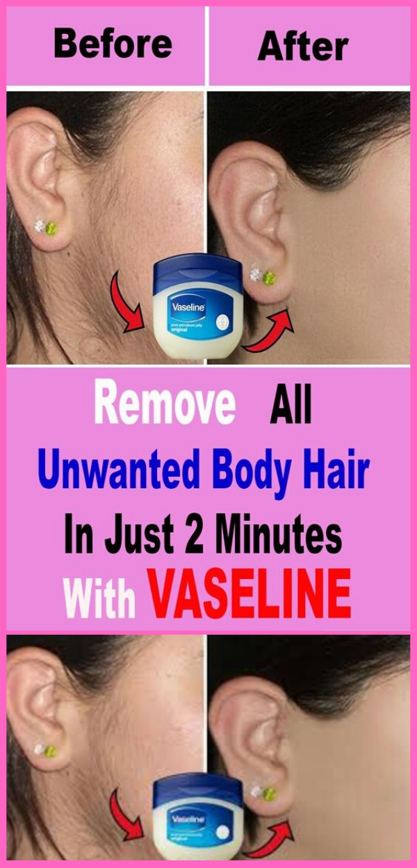 In 2 Minutes, Remove All Body Unwanted Hair Permanently At Home, With