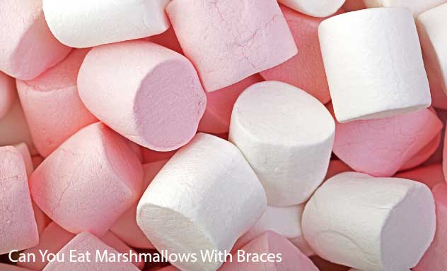 You Need To Know Can You Eat Marshmallows With Braces World Quotes