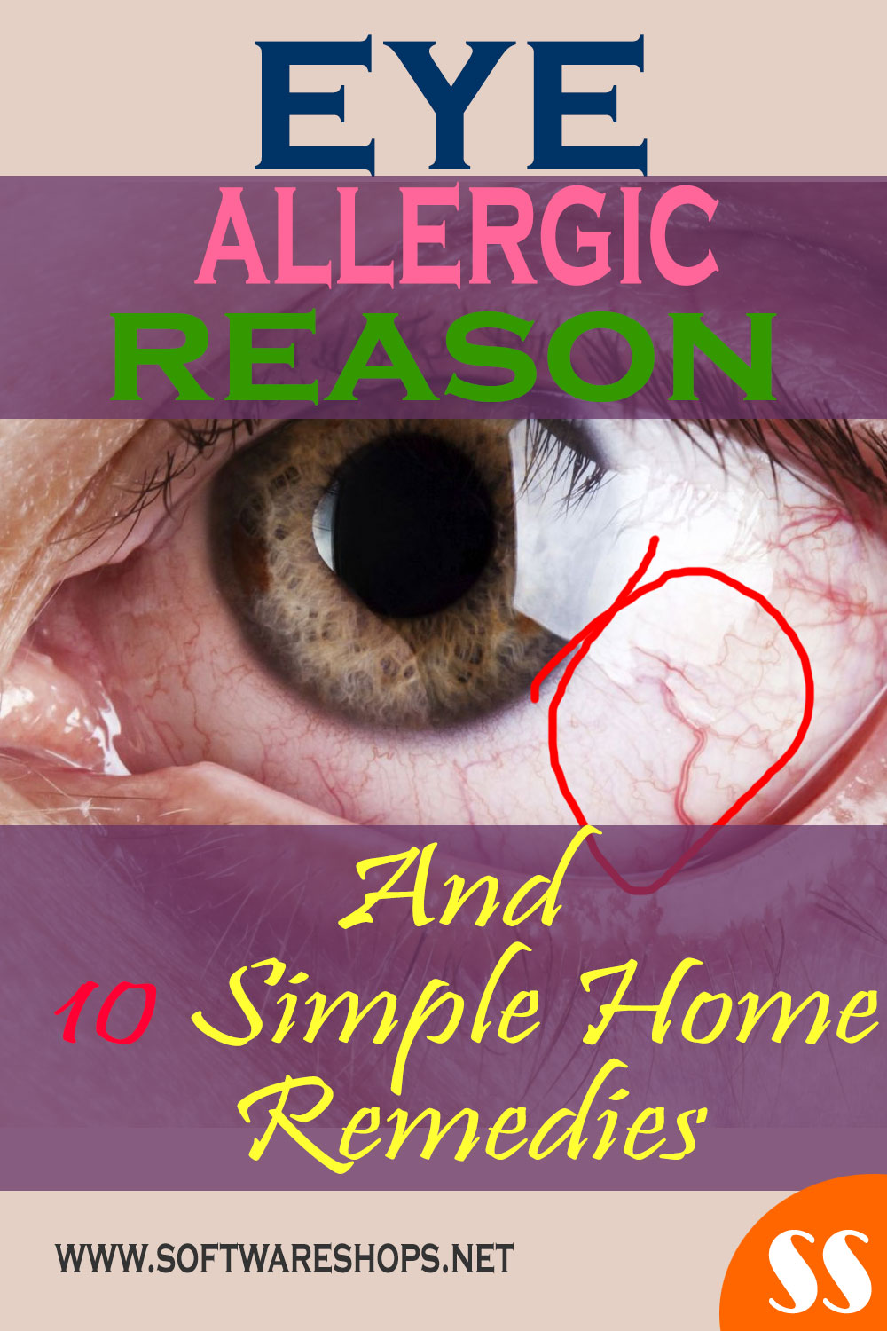 eye allergy home remedies