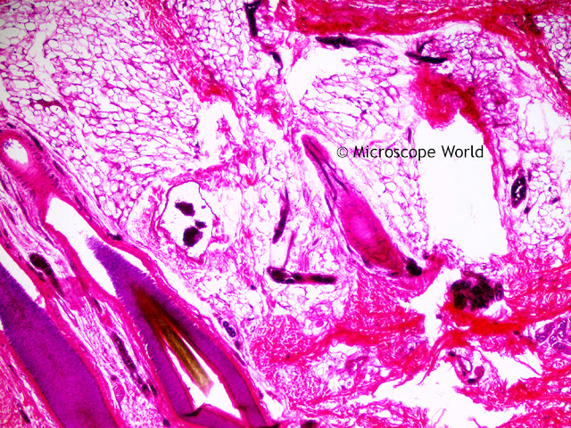 Image of hair and scalp under the microscope at 40x.