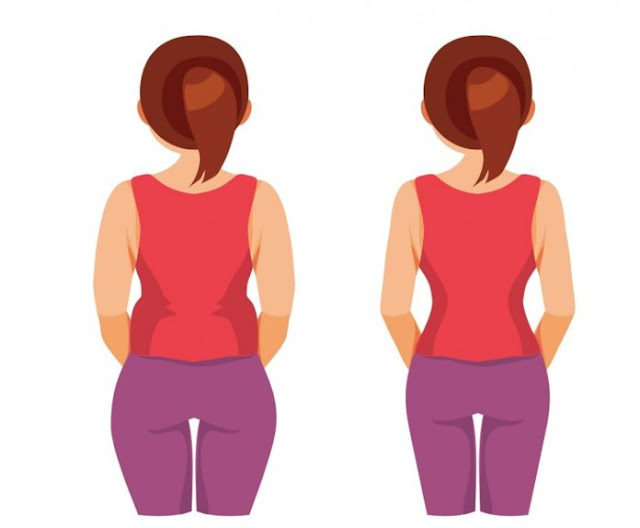 أسباب تراكم الدهون في منطقة الأرداف أسباب تراكم الدهون في منطقة الأرداف