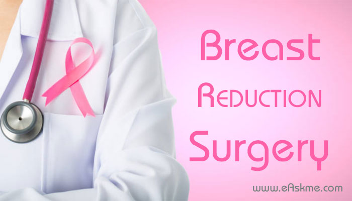 Everything That You Need To Know About Breast Reduction Surgery