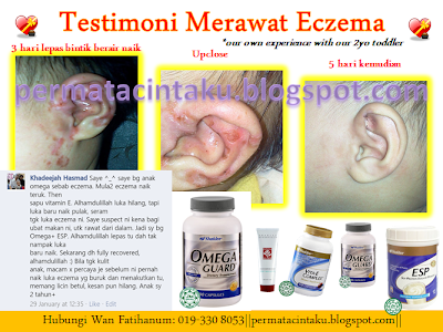 rawat ekzema dengan shaklee