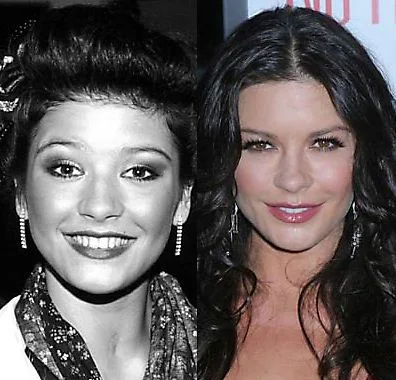 Breathtaking Jk Rowling Before And After Plastic Surgery Landscape Photography