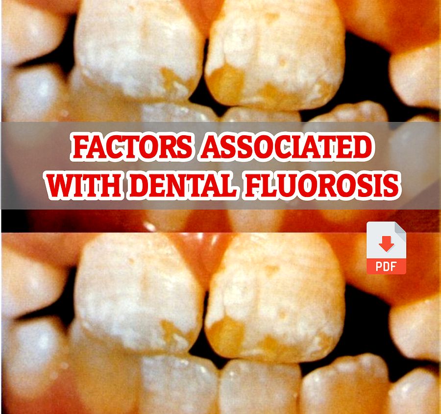 PDF Factors associated with Dental Fluorosis