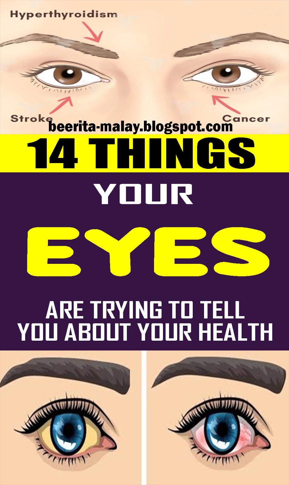 14 Things Your Eyes Are Trying To Tell You About Your Health