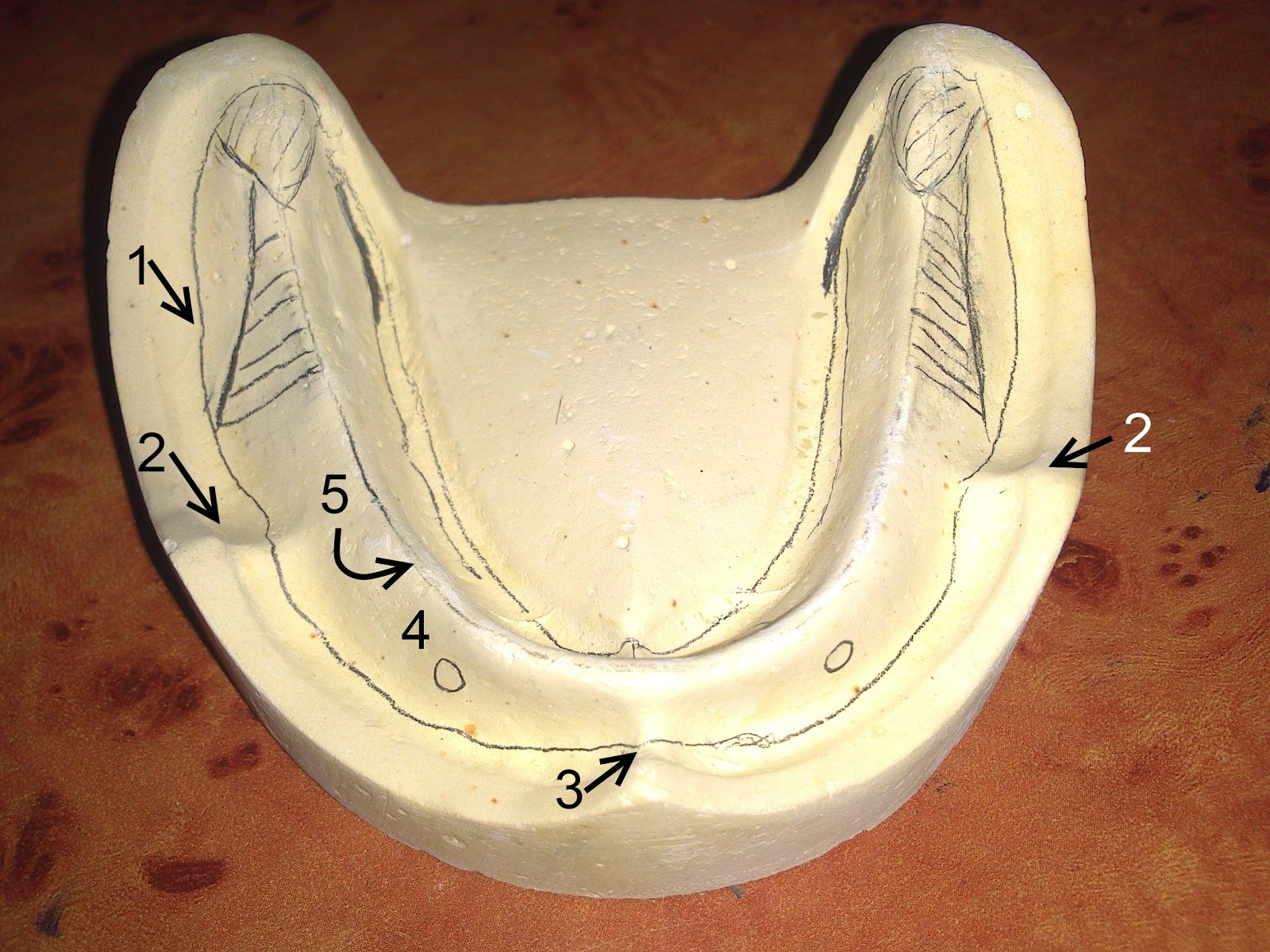Prosthodontics Anatomical Landmarks Hikayat Tabibatul Asnan